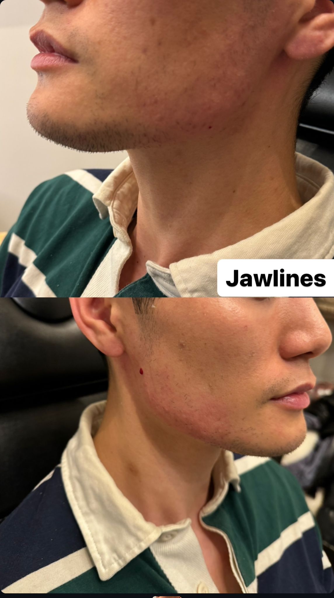 Jawlines Men 2