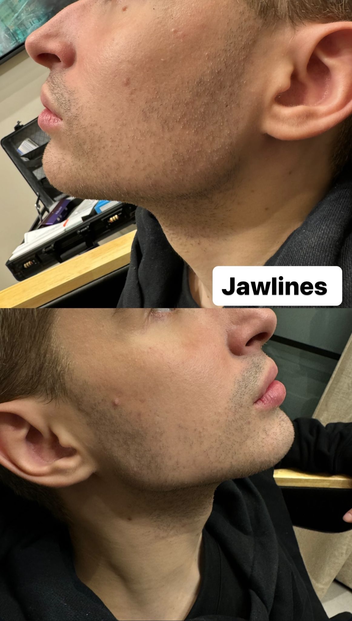 Jawlines Men 3